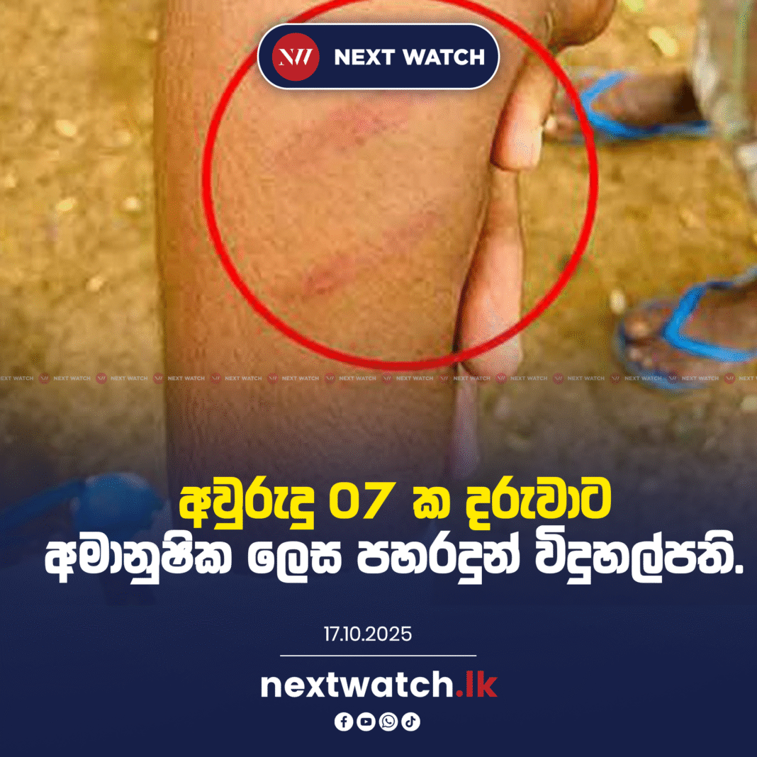 අවුරුදු 07 ක දරුවාට අමානුෂික ලෙස පහරදුන් විදුහල්පති.