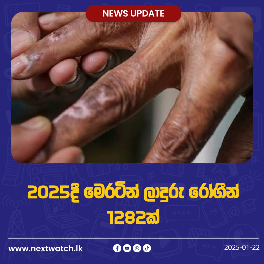 2025දී මෙරටින් ලාදුරු රෝගීන් 1282ක්